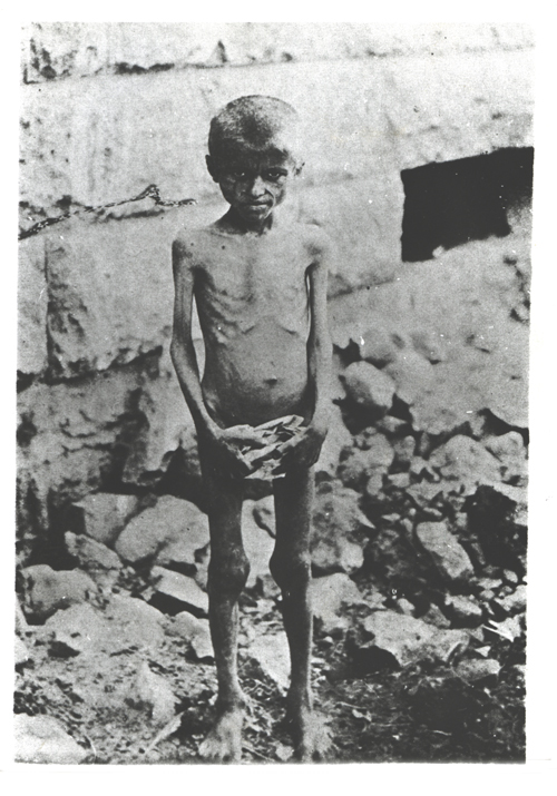 Hungerkranker armenischer Junge - (Ref-Nr. img044)
